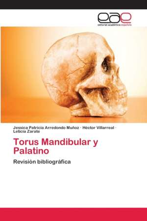 Torus Mandibular y Palatino de Jessica Patricia Arredondo Muñoz