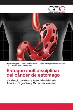 Enfoque multidisciplinar del cáncer de estómago de Roque Miguel Gálvez Fernández