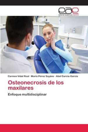 Osteonecrosis de los maxilares de Carmen Vidal Real