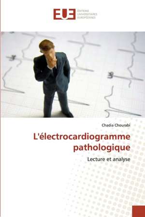 L'électrocardiogramme pathologique de Chadia Chourabi