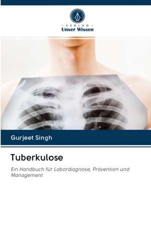 Tuberkulose de Gurjeet Singh