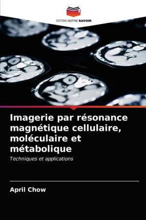 Imagerie par résonance magnétique cellulaire, moléculaire et métabolique de April Chow