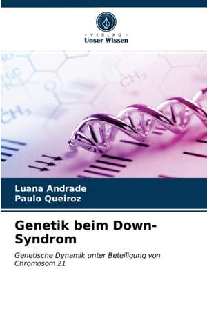 Genetik beim Down-Syndrom de Luana Andrade