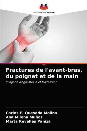 Fractures de l'avant-bras, du poignet et de la main de Carlos F. Quesada Molina