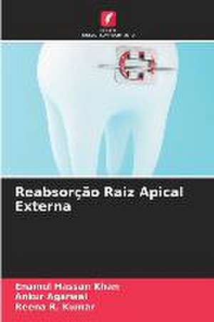 Reabsorção Raiz Apical Externa de Enamul Hassan Khan