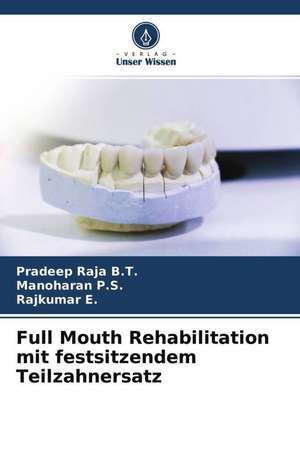 Full Mouth Rehabilitation mit festsitzendem Teilzahnersatz de Pradeep Raja B. T.