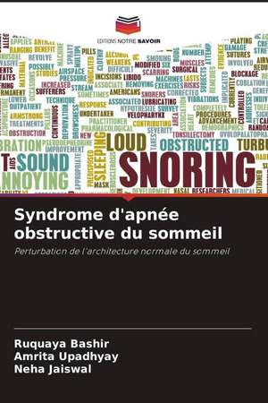 Syndrome d'apnée obstructive du sommeil de Ruquaya Bashir