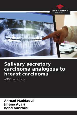 Salivary secretory carcinoma analogous to breast carcinoma de Ahmad Haddaoui