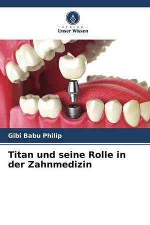 Titan und seine Rolle in der Zahnmedizin de Gibi Babu Philip