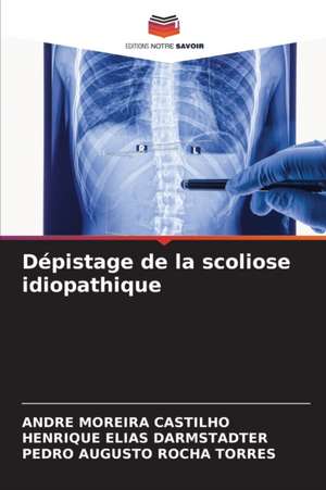 Dépistage de la scoliose idiopathique de Andre Moreira Castilho