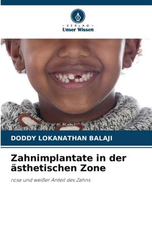 Zahnimplantate in der ästhetischen Zone de Doddy Lokanathan Balaji