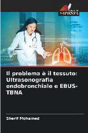 Il problema è il tessuto: Ultrasonografia endobronchiale e EBUS-TBNA de Sherif Mohamed