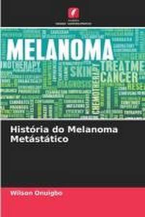 História do Melanoma Metástático de Wilson Onuigbo