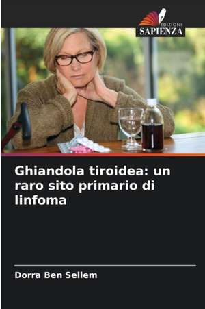 Ghiandola tiroidea: un raro sito primario di linfoma de Dorra Ben Sellem