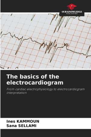 The basics of the electrocardiogram de Ines Kammoun