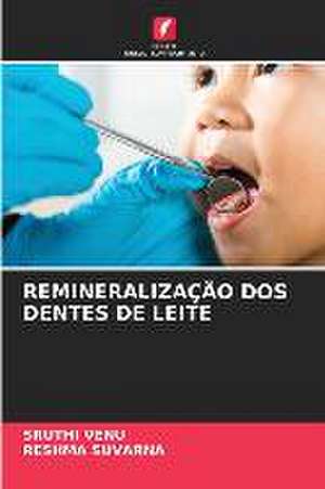 Remineralização DOS Dentes de Leite de Sruthi Venu