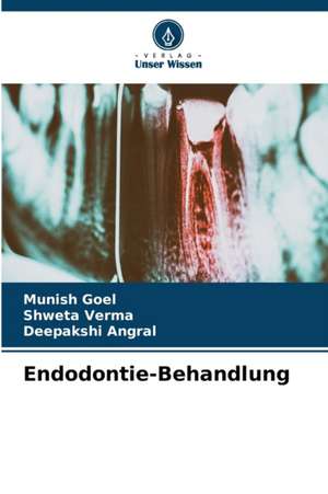 Endodontie-Behandlung de Munish Goel