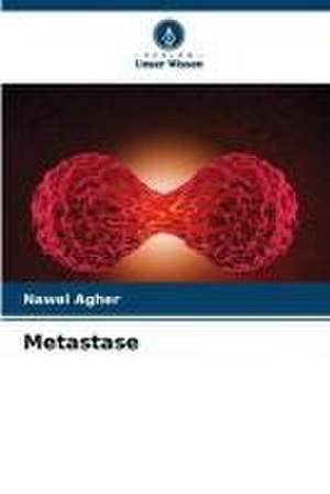 Metastase de Nawel Agher