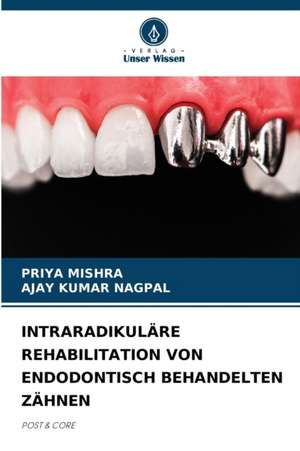 INTRARADIKULÄRE REHABILITATION VON ENDODONTISCH BEHANDELTEN ZÄHNEN de Priya Mishra