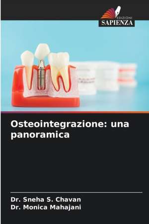 Osteointegrazione: una panoramica de Sneha S. Chavan