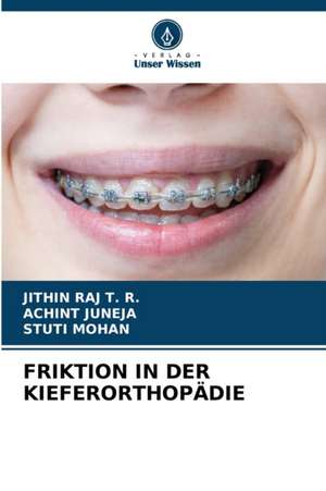 FRIKTION IN DER KIEFERORTHOPÄDIE de Jithin Raj T. R.