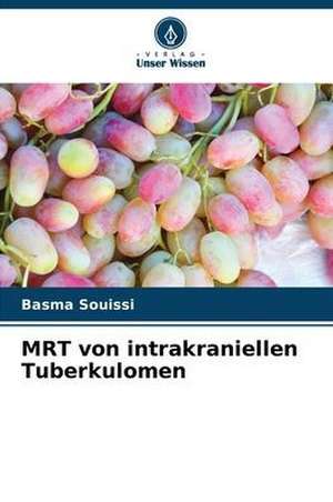 MRT von intrakraniellen Tuberkulomen de Basma Souissi