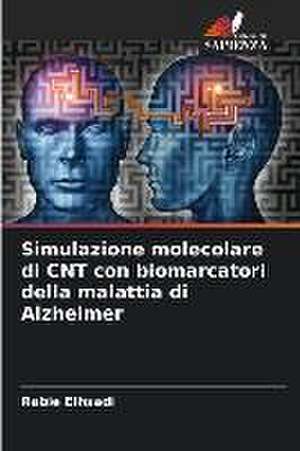 Simulazione molecolare di CNT con biomarcatori della malattia di Alzheimer de Rabie Elhsadi