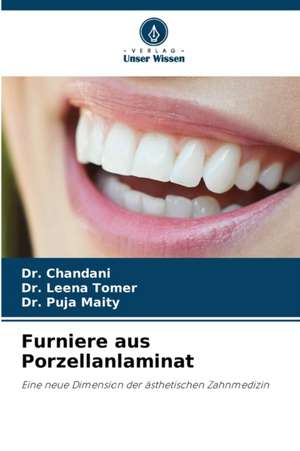 Furniere aus Porzellanlaminat de Chandani