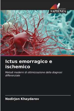 Ictus emorragico e ischemico de Nodirjon Khaydarov