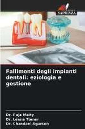 Fallimenti degli impianti dentali: eziologia e gestione de Puja Maity