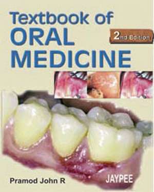 Textbook of Oral Medicine de Anil Govindrao Ghom