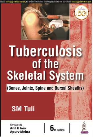 Tuberculosis of the Skeletal System de SM Tulsi