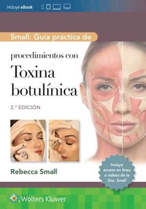 Small. Guía práctica de procedimientos con toxina botulínica de Rebecca Small MD, FAAFP