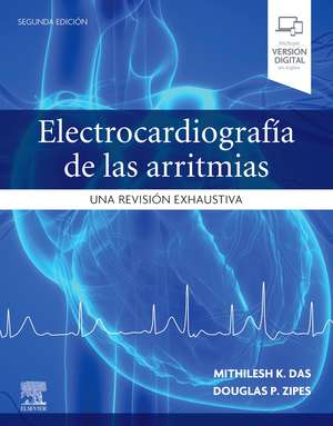 Electrocardiografía de las arritmias: Una revisión exhaustiva