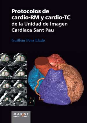 Protocolos de cardio-RM y cardio-TC de la Unidad de Imagen Cardiaca Sant Pau de Guillem Pons Lladó