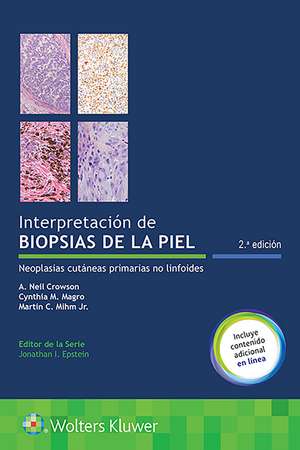 Interpretación de biopsias de la piel: Neoplasias cutáneas primarias no linfoides de A. Neil Crowson MD