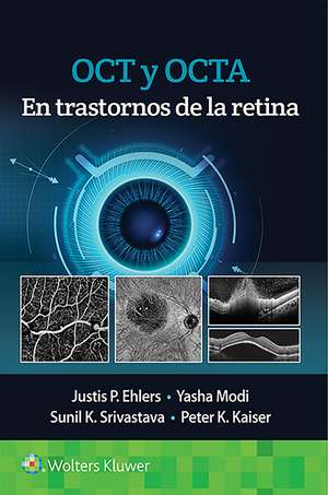 OCT y OCTA en trastornos de la retina de Justis P. Ehlers MD