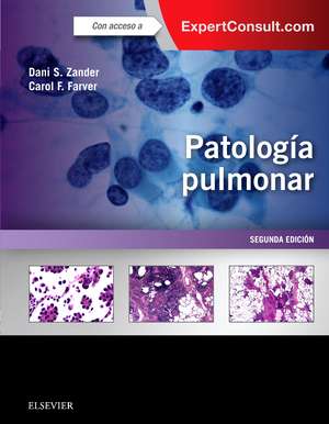 Patología pulmonar de Dani S. Zander