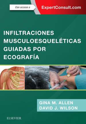 Allen, G: Infiltraciones musculoesqueléticas guiadas por eco