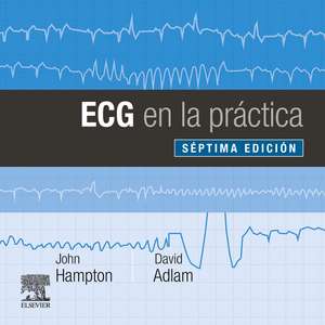 ECG en la práctica de John R. Hampton