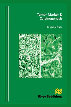 Tumor Marker and Carcinogenesis de Manjul Tiwari