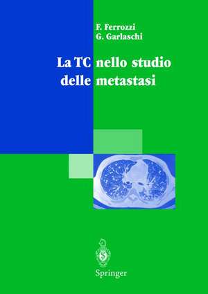 La TC nello studio delle metastasi de F. Ferrozzi