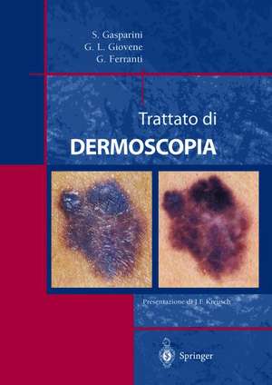 Trattato di Dermoscopia de Saturnino Gasparini