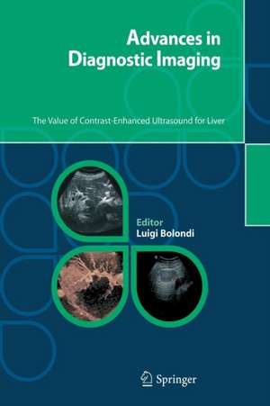 Advances in Diagnostic Imaging: The Value of Contrast-Enhanced Ultrasound for Liver de Luigi Bolondi