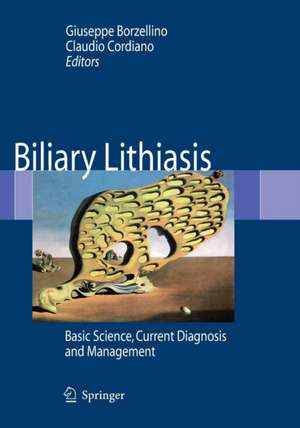 Biliary Lithiasis: Basic Science, Current Diagnosis and Management de Giuseppe Borzellino