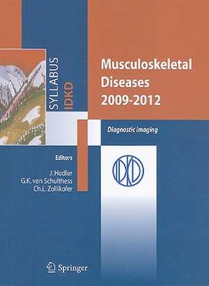 Musculoskeletal Diseases 2009-2012: Diagnostic Imaging de Gustav K. Schulthess