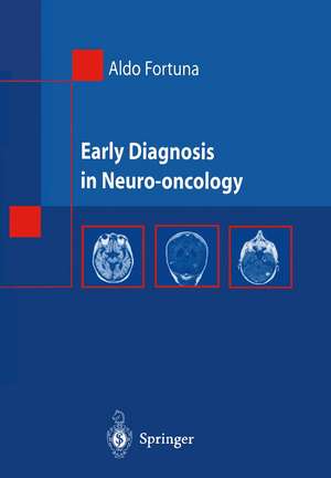 Early Diagnosis in Neuro-oncology de Aldo Fortuna