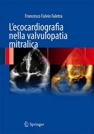 L'ecocardiografia nella valvulopatia mitralica de Francesco Fulvio Faletra