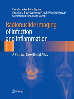 Radionuclide Imaging of Infection and Inflammation: A Pictorial Case-Based Atlas de Elena Lazzeri