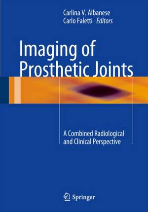 Imaging of Prosthetic Joints: A Combined Radiological and Clinical Perspective de Carlina V. Albanese